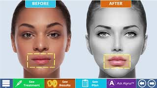 ALYNA AI Patient Consultation/Provider Training App screenshot 1