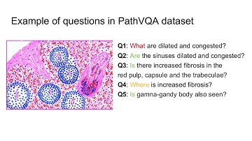 PathVQA: The First Step Towards an “AI Pathologist"