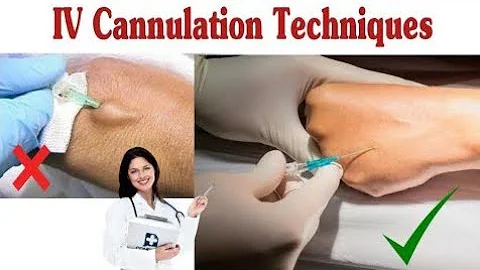 5  Reasons Why You are Bad At IVs  &  How To Fix These Mistakes