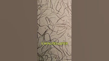 How Garlic affects Parasites? #naturalremedies #naturalmedicine #viralshort #fyp