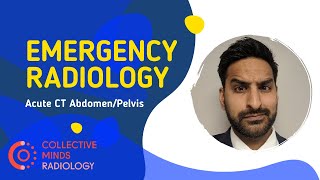 Acute Abdominal Case (Tutorial Series)