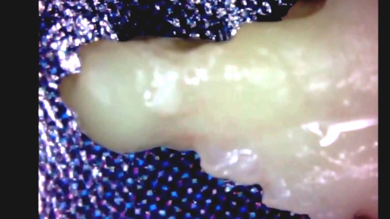 ife's Biggest Tonsil Stones, Ever; They Smell Like Deathballs! YouTube