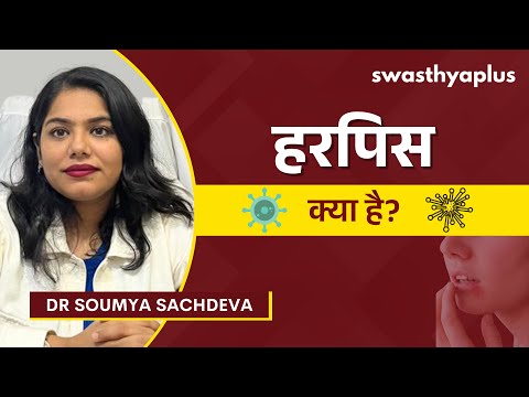 हरपिस: लक्षण और इलाज | Herpes: All you need to Know! in Hindi | Symptoms | Dr Soumya Sachdeva