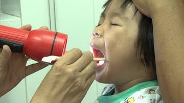 Bệnh trào ngược dạ dày thực quản ở trẻ em