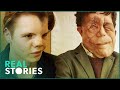 The ugly face of disability hate crime adam pearson documentary  real stories
