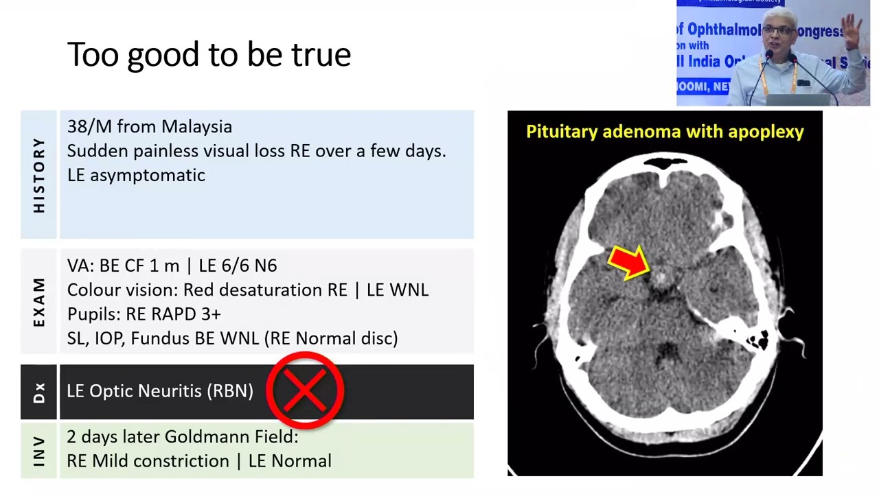 AIOS2025 IC251 T Dr Navin JAYAKUMAR Interesting Cases Diagnosed on History and Basic Investigations