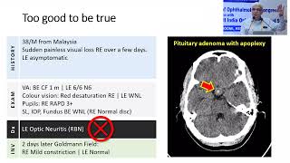 AIOS2025 IC251 T Dr Navin JAYAKUMAR Interesting Cases Diagnosed on History and Basic Investigations