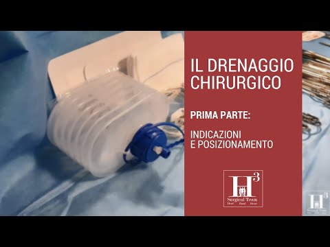 Video: Cos'è Il Drenaggio?