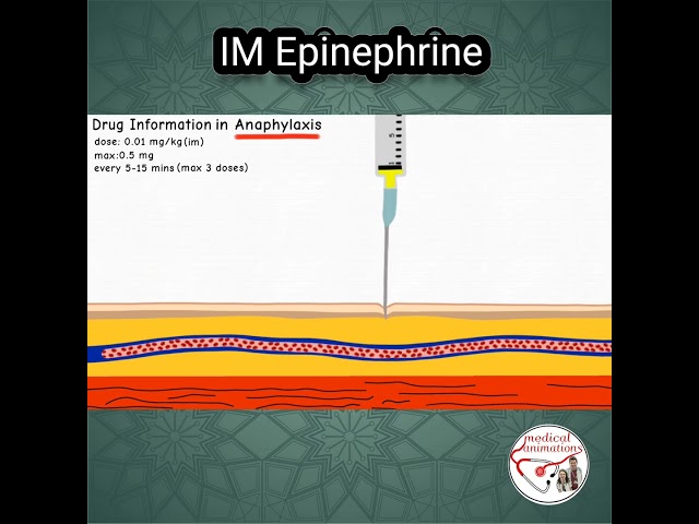 ADRENALINE (Epinephrine) DOSE in ANAPHYLAXIS #pediatrics #medicine #epinephrine class=