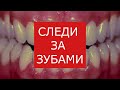 Поход к стоматологу. Ржака Риск. Кабинет зубного врача. Боль  смех Избыточный наркоз Любовь медицина