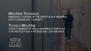 “Weld_on_5 “case