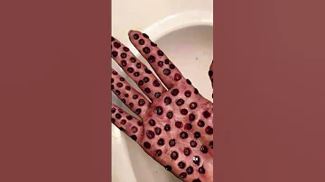 Do They Scare You Trypophobia Phobia 