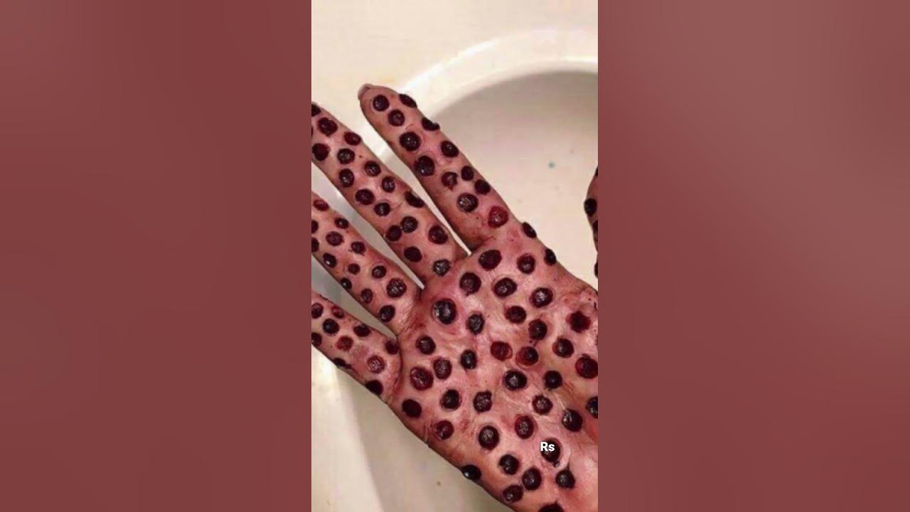 Do they scare you? #trypophobia #phobia