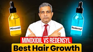 Minoxidil vs Redensyl - Best Hair Growth Solution? How to Apply Minoxidil | Minoxidil Hair Regrowth