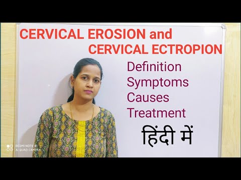 how to get rid of cervical erosion