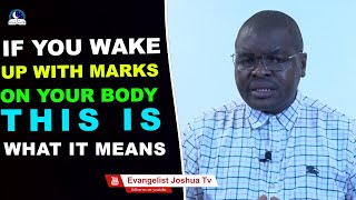 If You Wake Up With Marks On Your Body, This Is What it Means