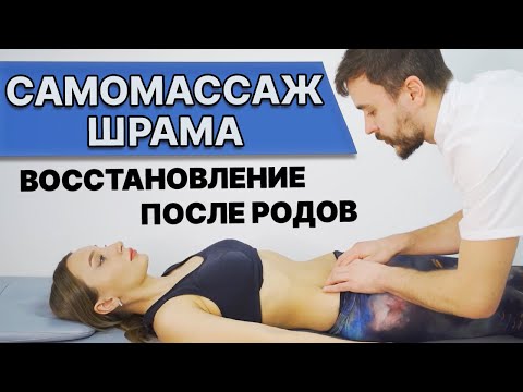 ПРОРАБОТКА ШРАМОВ и рубцов после КЕСАРЕВА с помощью массажа/остеопатии? Восстановление после родов.