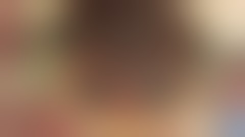 All-on-4® treatment concept clinical case: surgical procedure and denture conversion | Nobel Biocare