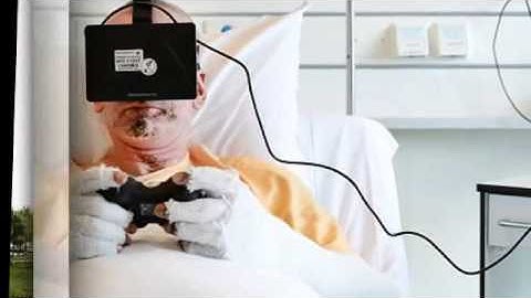 The future of pain relief  Dutch burns unit trialling new virtual reality computer system that