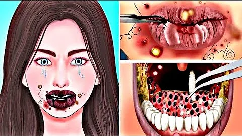 What Just Happened?! [ASMR Animation] Lip & Teeth Cleaning