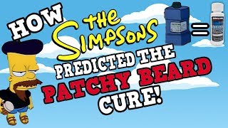 How The Simpsons Predicted The Cure For Patchy Beards