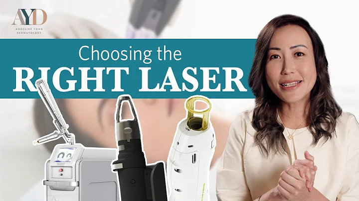 Choosing the right laser for YOU