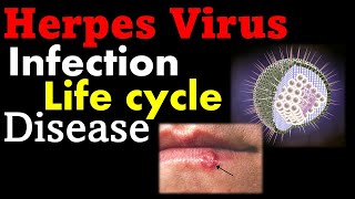 Herpes virus infection and treatment