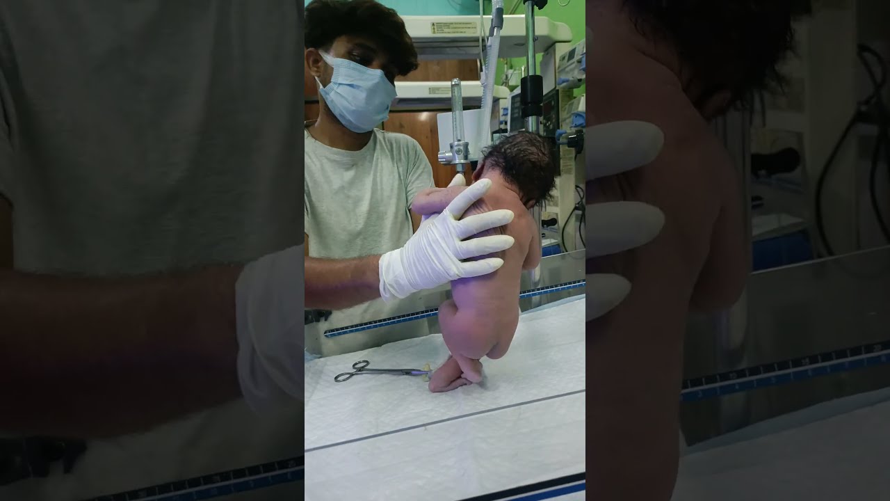 Newborn Baby After Birth Crying Motivation Video Virals Nursing Work Gnm