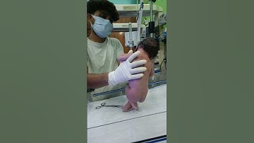 Thumbnail of newborn baby after birth #crying #motivation video #virals #nursing work gnm