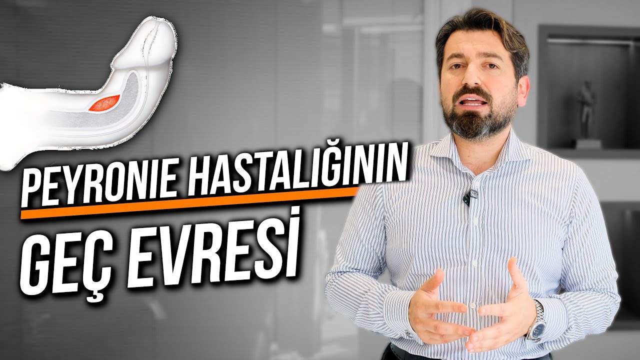 PEYRONIE HASTALIĞININ GEÇ EVRESİ