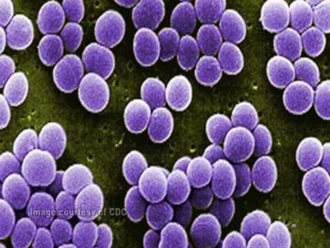 Video: Staphylococcus Aureus - Hvordan Spredes Stafylokokker, Infektionsmuligheder