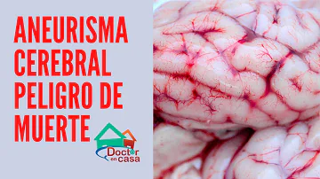 ¿Es el aneurisma cerebral una muerte rápida?