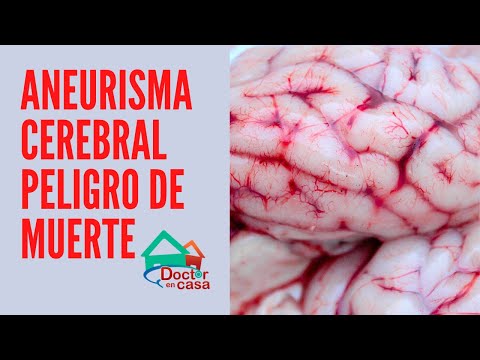 Vídeo: Aneurisma De Vasos Cerebrales: Síntomas, Consecuencias, Cirugía