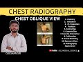Chest Oblique X-Ray View Explained | Positioning, Anatomy & Interpretation