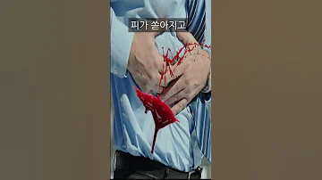 칼에 찔렸을때 살아남는 방법 칼뽑기vs그대로두기 