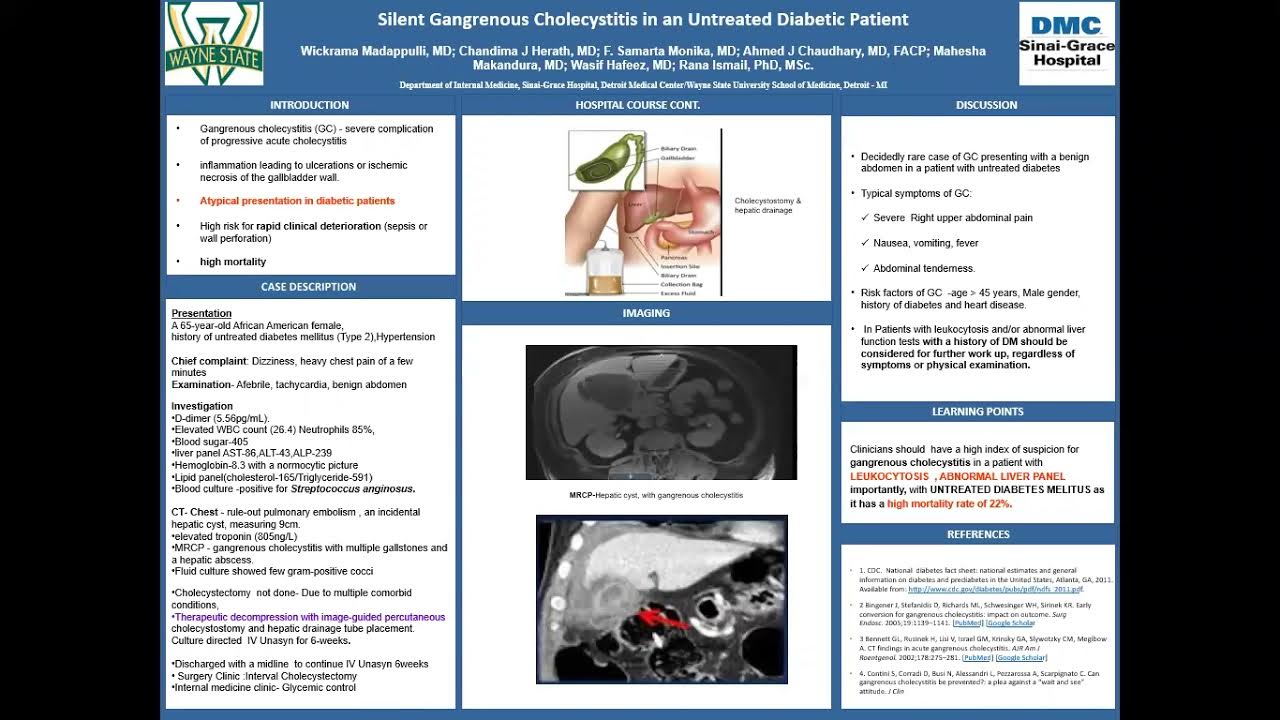 ACP poster presentationMadappulli Wickrama MD YouTube