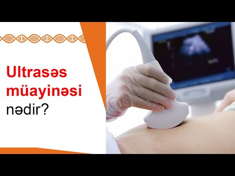 Video: Ultrasəs nebulizer nədir?