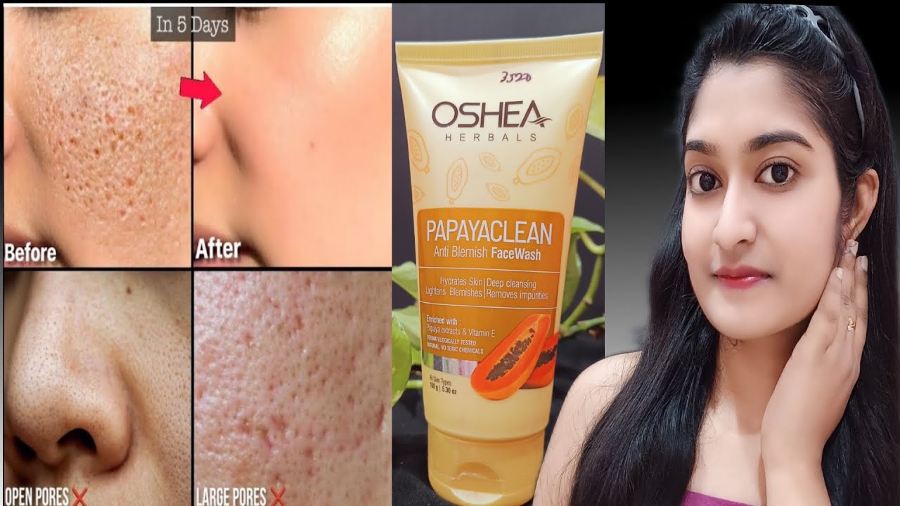 Oshea papaya face wash honest review l oshea face wash Indigenous