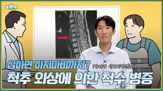 [활기찬 클리닉] 넘어지고 나서 통증이 계속된다면? ‘척수 병증’ 주의! ⚠️ - 성재경 신경외과전문의 | 250618