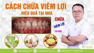 6 cách chữa viêm lợi hiệu quả tại nhà