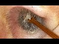 【耳掃除】#157 〜ニシ(西)の耳帝王!?〜 earwax