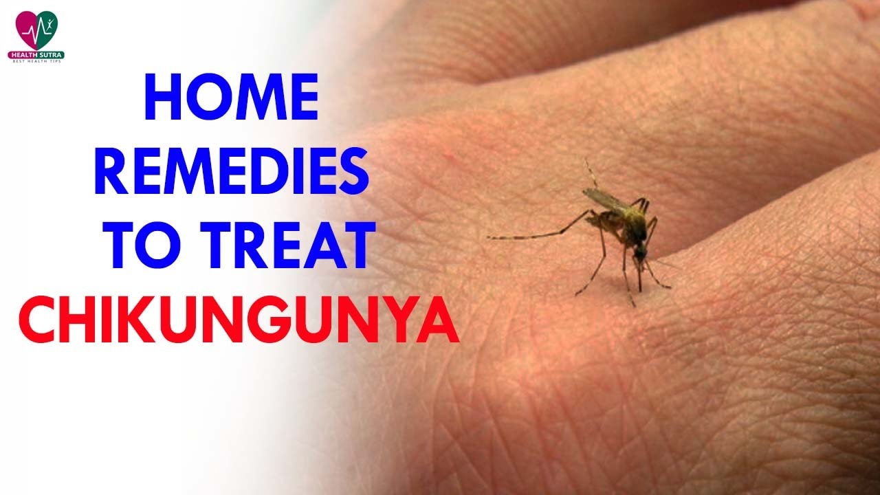 Home Remedies To Treat Chikungunya Health Sutra YouTube