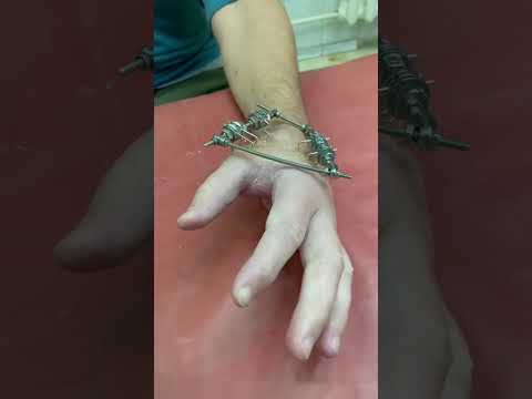 Мини аппарат Илизарова