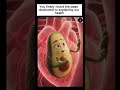 Your diet doesn’t only impact your belly, your heart feels it too! #shorts #diet