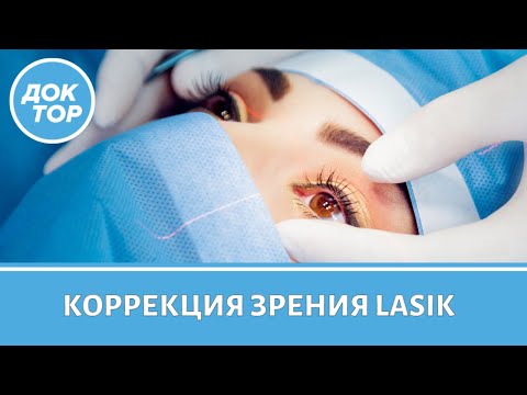 Офтальмолог о лазерной коррекции зрения методом Lasik