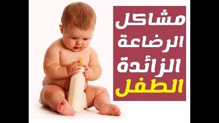 مشاكل الرضاعة الزائدة علي الطفل
