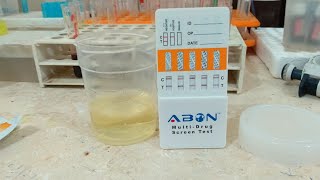 تحليل المـ خــ درات فى البول وما هى طرق المراوغة للهروب من التحليل ؟ urine toxicoloy screen