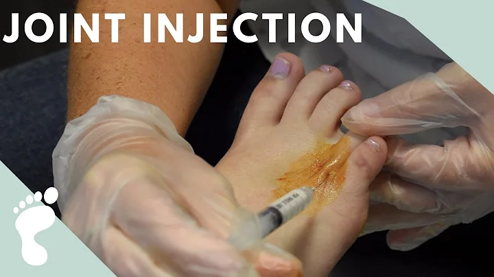 Steroid Joint Injection | Dr. Jamie Carter