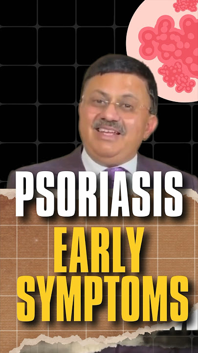 Download lagu Psoriasis Early Symptoms | Psoriasis Explained | Get Answers from a Top Dermatologist