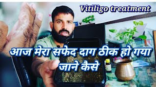 Video Vitiligo Vlogger सफेद दाग का इलाज है बहुत आसान 